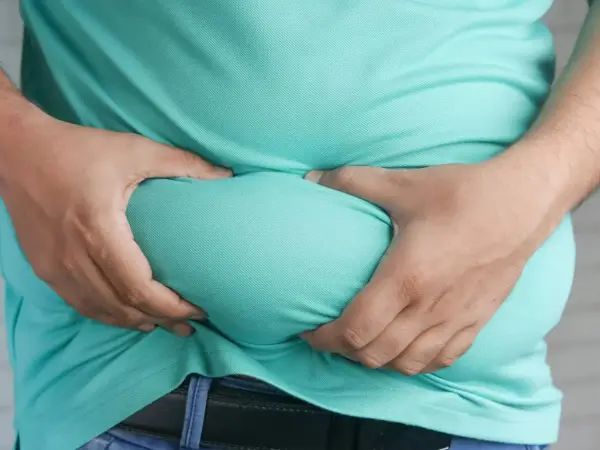 Obezitatea – boala secolului XXI